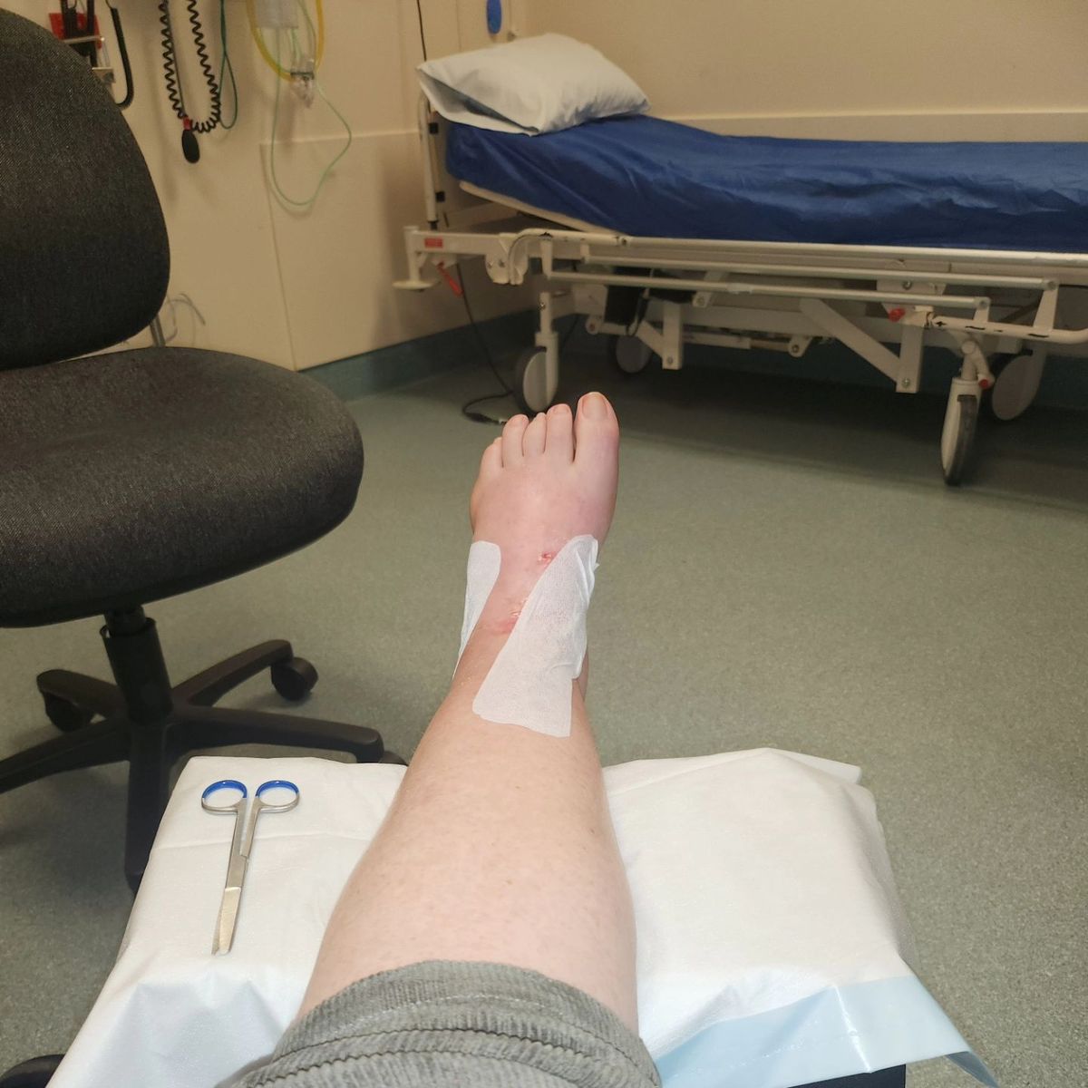 Ankle post op